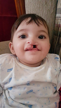 Малак Алескерова